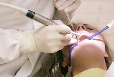 se puede comer normal con implantes dentales
