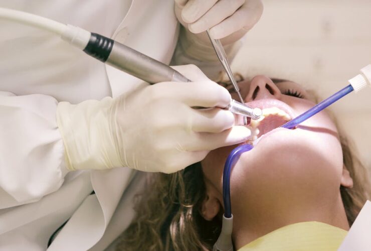 se puede comer normal con implantes dentales